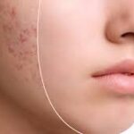 10 Daily Habits Cause Dark Spots, Avoid them