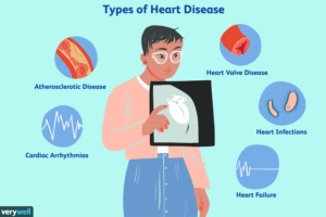 Types of Heart Disease 